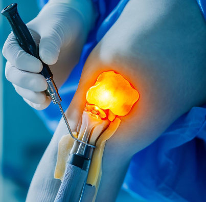 orthopedic doctor in secunderabad